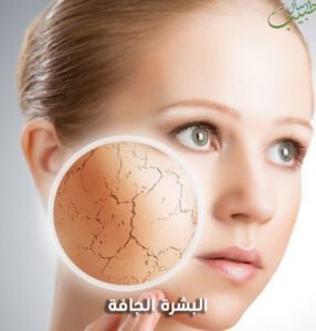 البشرة الجافة