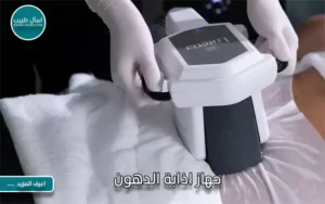 جهاز اذابة الدهون