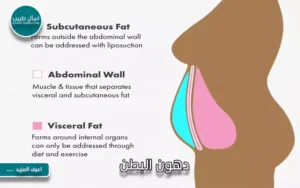 دهون البطن