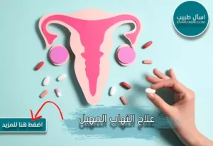 علاج التهاب المهبل