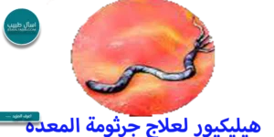هيليكيور لعلاج جرثومة المعدة