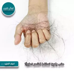متى يكون تساقط الشعر خطيراً؟