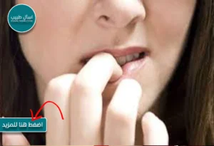 أضرار أكل الأظافر