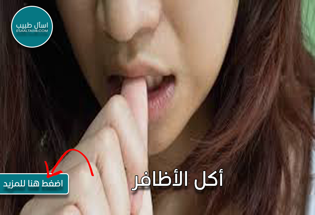 أكل الأظافر
