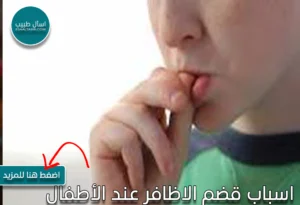 اسباب قضم الاظافر عند الأطفال