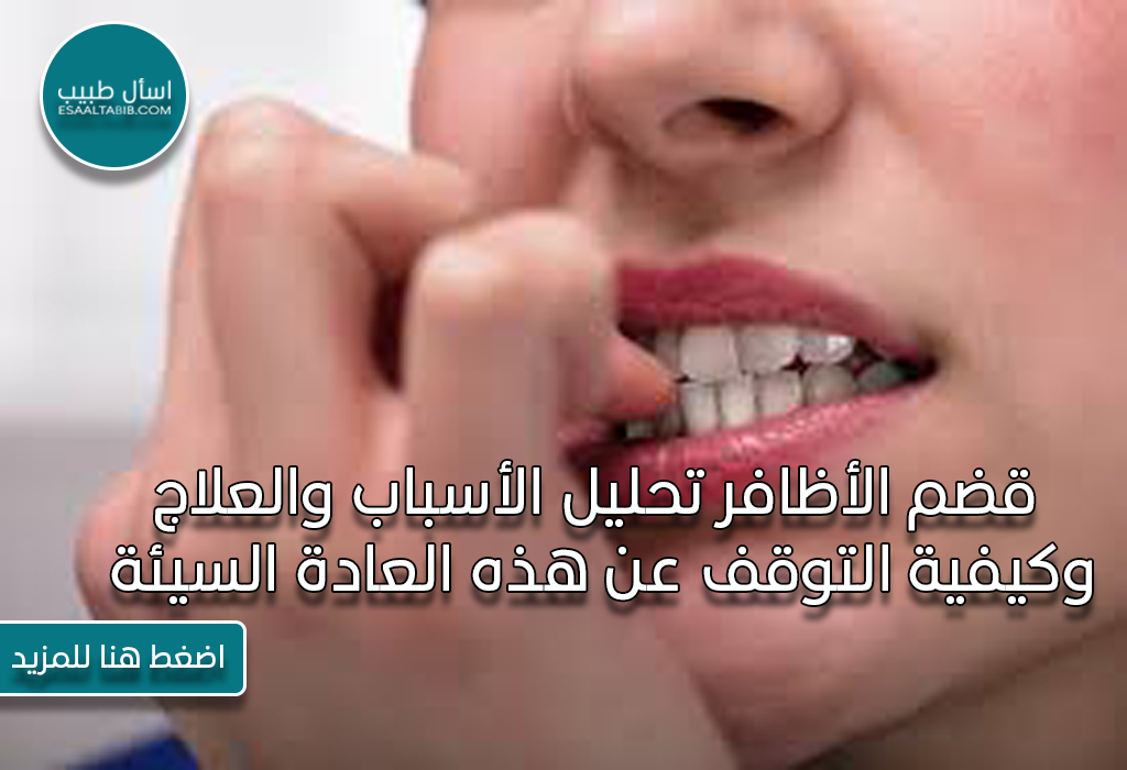قضم الأظافر