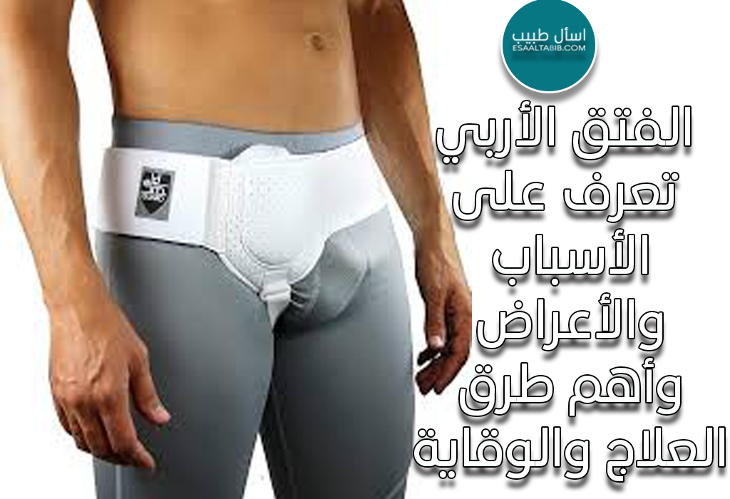 الفتق الأربي