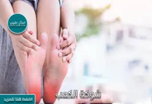 شوكة الكعب