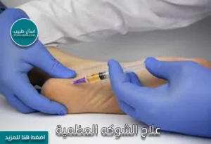 علاج الشوكه العظمية