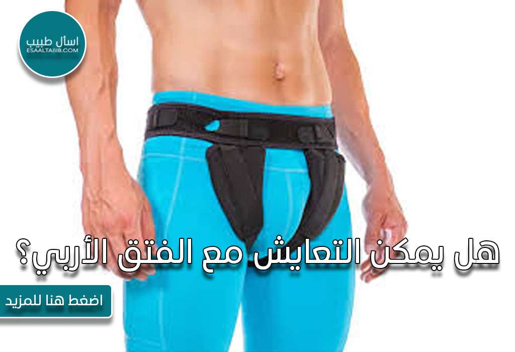 هل يمكن التعايش مع الفتق الأربي
