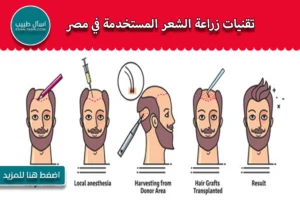 "تقنيات