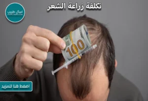 تكلفة زراعة الشعر