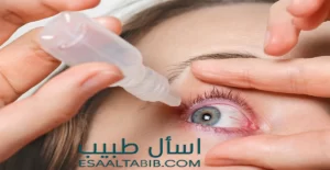 قطرات التخدير لعملية الليزك