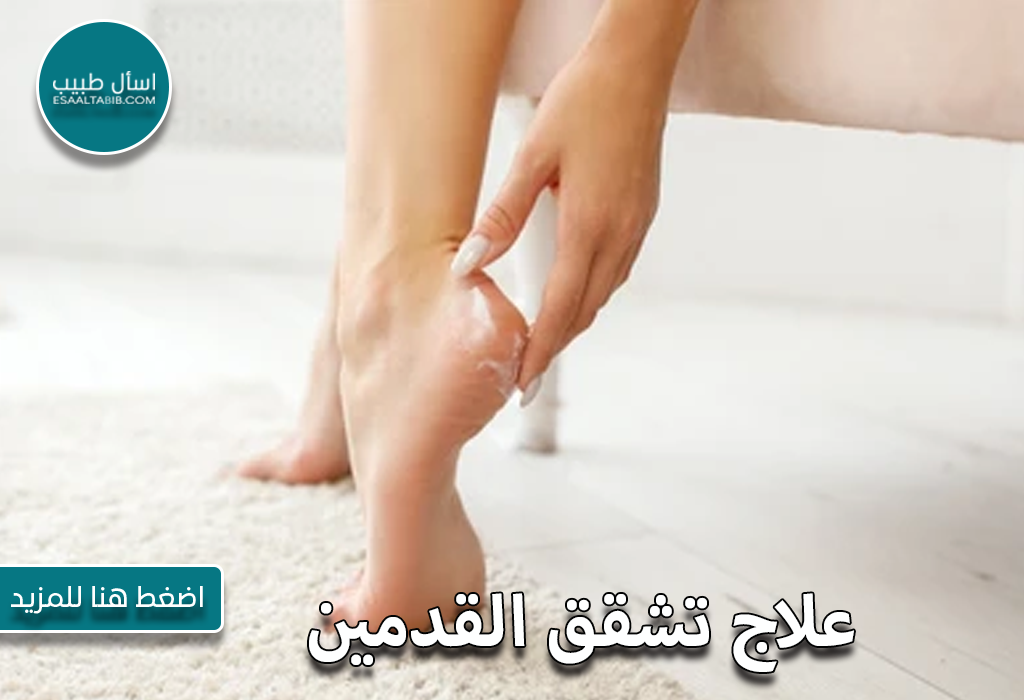 علاج تشقق القدمين