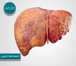 "تعريف