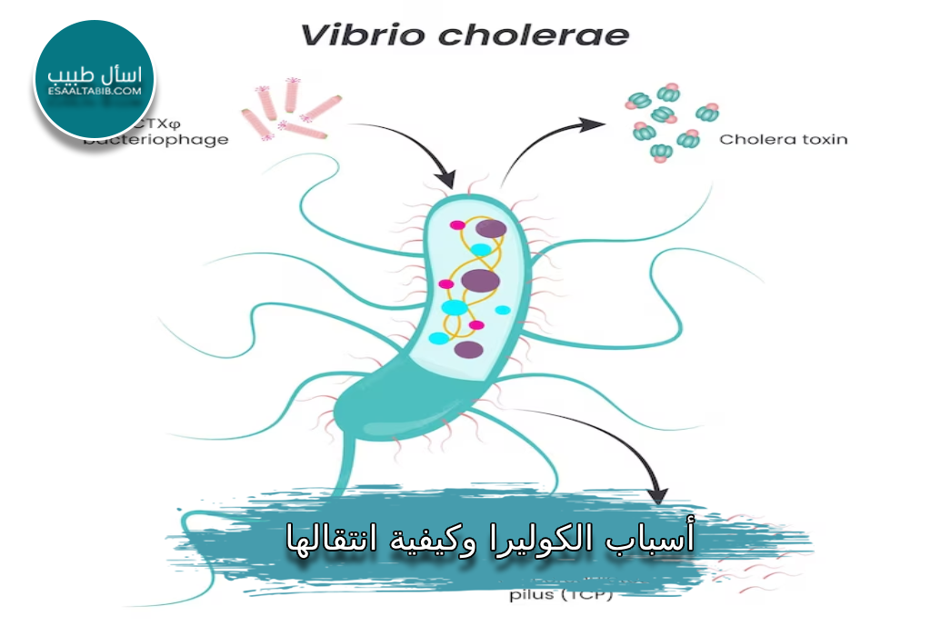 أسباب الكوليرا وكيفية انتقالها