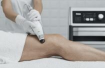 تفاصيل جلسة علاج بالليزر للبشرة مع شخص يعاني من احمرار خفيف وتورم